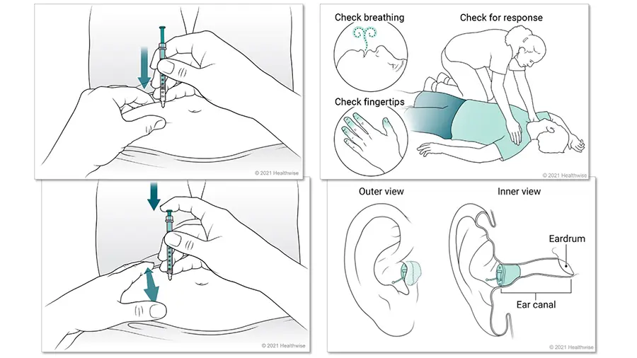 Four illustrations showing simplified line art of how to do something or how a medical device works.