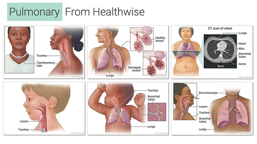 Six illustrations about a variety of pulmonary topics, showing people who differ in age, race, and body type.