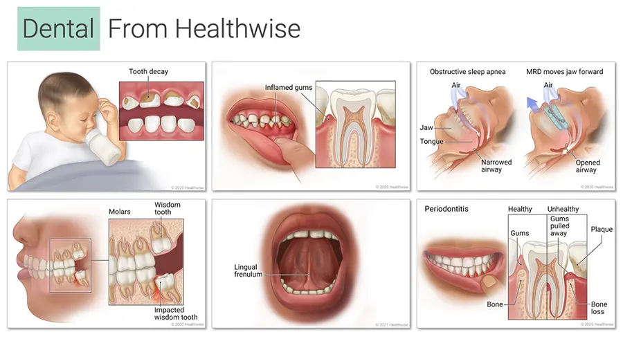 Six illustrations about a variety of dental topics, showing people who differ in age, race, and body type.